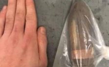Hospital chama esquadrão antibombas para homem com projétil “introduzido” no ânus