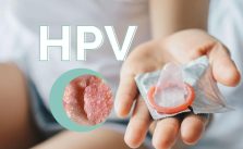 ALÔ DOUTOR: O QUE VOCÊ PRECISA SABER SOBRE O HPV