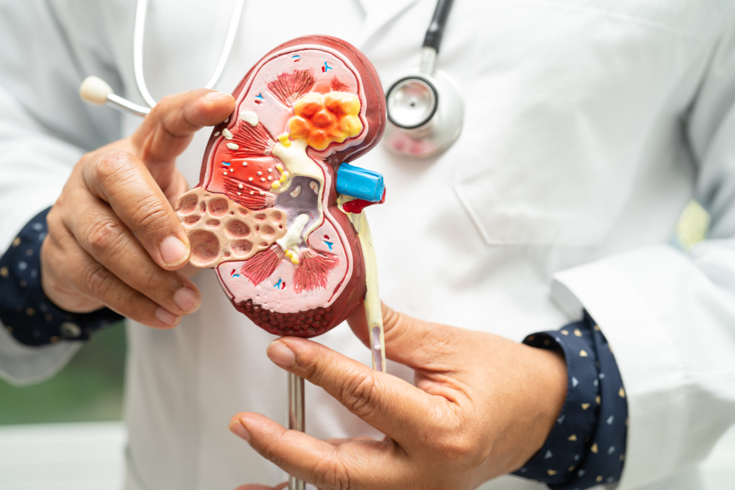 SAÚDE DOS RINS EM DIA com a Dra. Carla Cristina Bernardi: Doença Renal do Diabetes: O que é? Como identificar?
